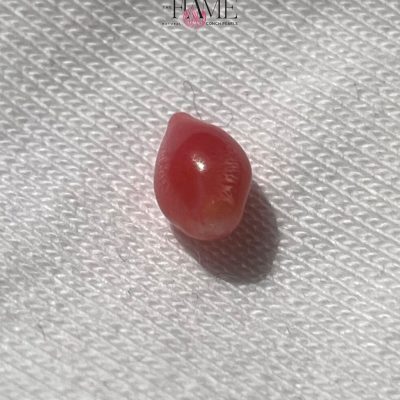 8- 0.9ct Dark Pink Natural Conch Pearl , with tear shape and flame